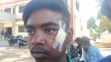 पन्ना: ग्राम कटरा की आदिवासी बस्ती में बाड़ा का टटवा चोरी करने के शक में आरोपियों ने एक दर्जन लोगों के साथ की मारपीट