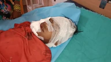 मथुरा: गोवर्धन में दान घाटी रोड पार करते वक्त 10 वर्षीय मासूम को ई रिक्शा ने मारी टक्कर गंभीर हालत में अस्पताल में कराया भर्ती