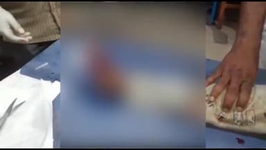 अररिया: मसूरिया के पास साइकिल चलाने के क्रम में पैर फस जाने से किशोर हुआ घायल, सदर अस्पताल में भर्ती