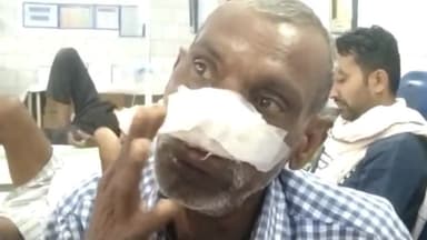 पन्ना: बिरवाही गांव में खेत की रखवाली कर रहे पति-पत्नी पर जंगली जानवर ने किया जानलेवा हमला, जख्मी का अस्पताल में हुआ इलाज