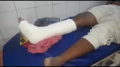 अररिया: बलुवा चौक के समीप चार चक्का वाहन की टक्कर से बाइक सवार हुआ  घायल सदर अस्पताल में भर्ती