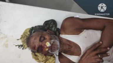 हलसी: राता गांव में ज़मीनी विवाद में दो पक्षों में चले लाठी-डंडे, एक व्यक्ति गंभीर रूप से हुआ घायल