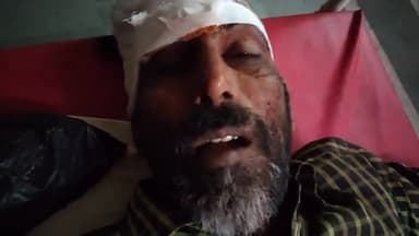 धौलपुर: पटपरा मोहल्ले में दीवाल खींचने को लेकर 45 वर्षीय अधेड़ के साथ चार लोगों ने की लाठी डंडों से बेरहमी से मारपीट