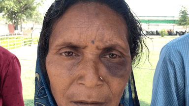 सिंगरौली: बिछी गांव निवासी पीड़िता के साथ हुई मारपीट में महिला के बच्चेदानी में लगी गहरी चोट, पीड़िता ने एसपी से लगाई मदद की गुहार