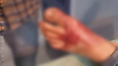 सिमरिया: सिमरिया-अमानगंज मुख्य सड़क मार्ग पर कृष्णा वेयरहाउस के पास बाइक अनियंत्रित होकर गिरने से दो युवक घायल