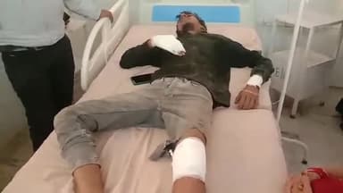 मुरादाबाद: रेलवे कॉलोनी में तेज रफ्तार बाइक अनियंत्रित होकर फिसली, बाइक सवार युवक हुआ घायल