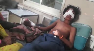 राघोगढ़: गोरा गांव में 12 साल के बच्चे के हाथ में मोबाइल की बैटरी फटने से हुआ गंभीर घायल, अस्पताल में भर्ती