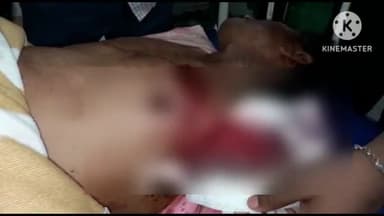 फिरोज़ाबाद: गांव सुजावलपुर में प्लाट के विवाद के चलते एक व्यक्ति सीने में गोली लगने के कारण हुआ घायल, आगरा किया गया रेफर
