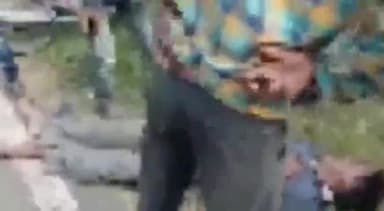 चितरंगी: ग्राम रमडीहा के पास एक बाइक सवार अनियंत्रित होकर गिरा, आई चोट