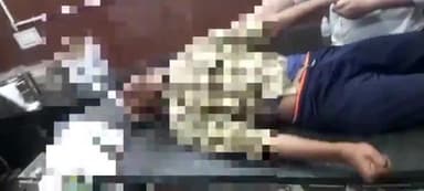 मिर्ज़ापुर: बरकच्छा के बीएचयू कॉलेज में बीकॉम व वीवोक के छात्रों में पुरानी रंजिश को लेकर हुई मारपीट, एक छात्र की हालत गंभीर