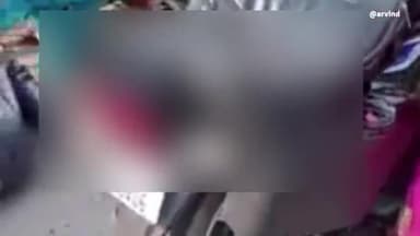 सिंगरौली: तेलदह गडरिया मुख्य सड़क मार्ग पर बाइक सवार 2 लोग अनियंत्रित होकर गिरे, घायलों का ट्रॉमा सेंटर में इलाज जारी