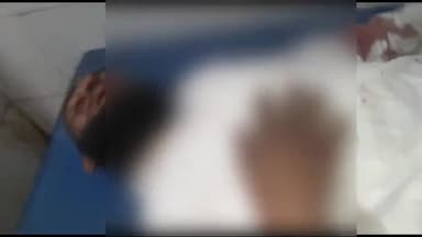 अररिया: मदनपुर थाना के समीप अनियंत्रित बाइक सवार ने एक व्यक्ति को मारी टक्कर हादसे में दोनों ही घायल सदर अस्पताल में भर्ती