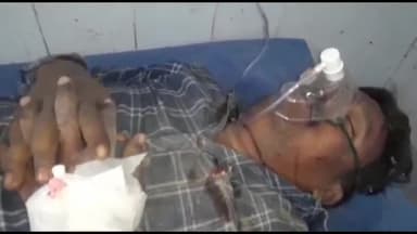 अररिया: टेंगराहा के समीप बाइक अनियंत्रित होकर सड़क पर फिसल जाने के कारण 2 लोग घायल सदर अस्पताल में भर्ती