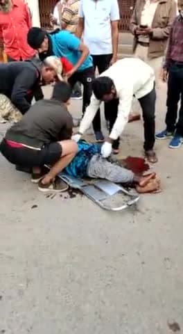 एक महिला बुरी तरह घायल , हॉस्पिटल पहुंचाया गया हैं