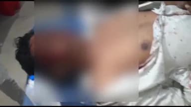 अररिया: गैयारी यादव चौक के समीप दो बाइकों के बीच हुई टक्कर, दो लोग हुए घायल