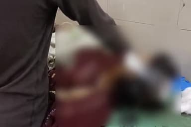 बहराइच: चेतरा के पास सड़क पर पड़े बिजली के तार से फंसकर बाइक सवार पति-पत्नी हुए घायल, महिला को लखनऊ किया गया रेफर