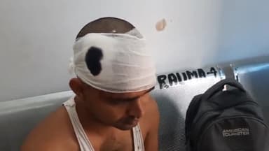 सासाराम: भलूआडी गांव के पास आपसी विवाद को लेकर दो पक्षों में हुई मारपीट, घटना में घायल युवक का सदर अस्पताल में इलाज जारी