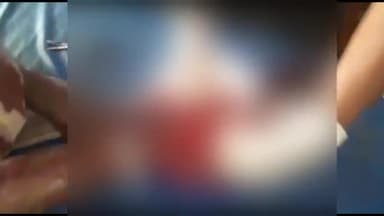 अररिया: मजलिशपुर के समीप सिटी रिक्शा पलटने से चालक हुआ घायल, सदर अस्पताल में इलाज के बाद किया गया रेफर