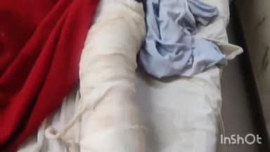 लाडपुरा: महावीर नगर इलाके में पैदल घूम रहे व्यक्ति को मोटरसाइकिल सवार युवक टक्कर मारकर फरार घायल MBS अस्पताल में भर्ती