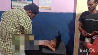 रायबरेली: बछरावां में मंदिर के अंदर आरती के दीपक से जलकर घायल हुआ बच्चा, अस्पताल में कराया भर्ती