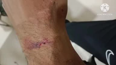 आगर: बैजनाथ मंदिर के चौकीदार के साथ निपानिया बैजनाथ के एक युवक ने की मारपीट, आगर कोतवाली पुलिस ने दर्ज किया प्रकरण