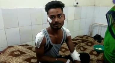 टीकमगढ़: सुकलान गांव में बाइक अनियंत्रित होने से एक व्यक्ति गंभीर रूप से हुआ घायल जिला अस्पताल में उपचार जारी