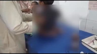 अररिया: काकन गांव में गर्म सब्जी में गिरकर झुलसा बच्चा, सदर अस्पताल में भर्ती