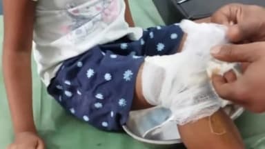 अमानगंज: ताराग्राम के पास जंगली सूअर बाइक के सामने आ जाने से बाइक हुई अनियंत्रित, 3 लोग हुए घायल