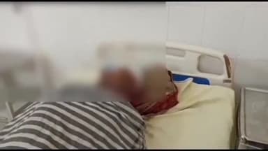 मुरादाबाद: देहात थाना क्षेत्र में आवारा कुत्तों ने हमला कर 10 लोगों को किया जख्मी सभी को अस्पताल में एंटी रेबीज इंजेक्शन लगाया गया