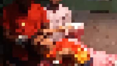 बलियापुर: हीरक रोड पर पलानी के पास सड़क दुर्घटना में एक व्यक्ति हुआ घायल, स्थानीय लोगों ने भेजा अस्पताल