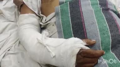 लाडपुरा: किशनगंज थाना क्षेत्र में मोटरसाइकिल सवार अधेड़ के सामने अचानक गाय आने से दुर्घटना का शिकार गंभीर घायल MBS में भर्ती