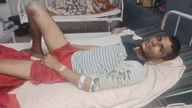 मथुरा: गांव पाली खेड़ा में मजदूरी करते वक्त पटिया गिरने से मजदूर घायल, उपचार हेतु अस्पताल में भर्ती