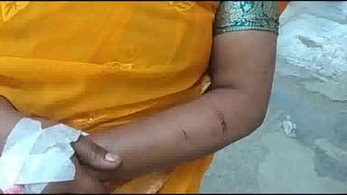 दरभंगा: दरभंगा के टाउन थाना के गुल्लू बारा में जमीन में दारू नहीं रखने देने पर महिला को मारपीट कर किया घायल डीएमसीएच में भर्ती