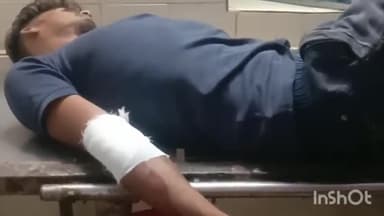 बड़ा मलेहरा: सरगुवा तिगड्डा तेज रफ्तार अज्ञात काऱ की टक्कर से बाईक चालक हुआ घायल