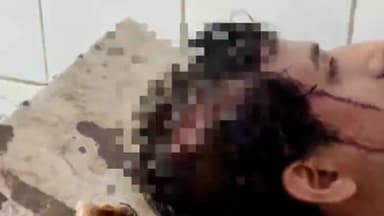 कामां: जुरहरा में दुकानदार पर 2 लोगों ने किया हमला, घायल दुकानदार को अस्पताल में कराया गया भर्ती