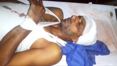 मुरादाबाद: मिलक धर्मपुर में मामूली कहासुनी के चलते दो पक्षों के बीच जमकर चले लाठी-डंडे, एक ही परिवार के 5 लोग हुए घायल