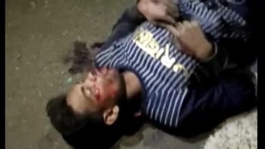 सिवनी: सोनाडोंगरी गांव के पास अज्ञात वाहन ने बाइक सवार युवक को मारी टक्कर, घायल युवक जिला अस्पताल में भर्ती