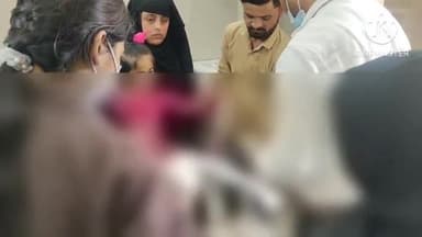 फिरोज़ाबाद: मोहम्मदपुर में खौलते तेल की कढ़ाई पलटने से साढ़े चार वर्षीय बालिका झुलसी