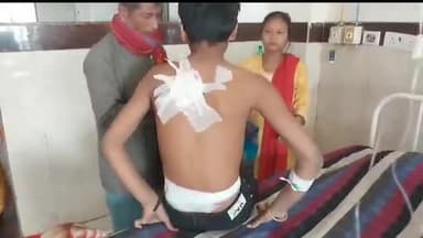 बेतिया: सहोदरा मेला ग्राउंड में मेला देखने गए लड़के पर चाकू से किया गया जानलेवा हमला, जीएमसीएच में कराया गया भर्ती