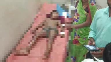 कन्नौज: अमरापुर गांव में पटाखे से 7 वर्षीय बच्ची के जलकर घायल होने का मामला आया सामने, परिजनों ने जिला अस्पताल में कराया भर्ती