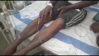 अररिया: धोबनिया गांव में मक्का पटवन करते समय एक युवक को विषैले सर्प ने डसा, सदर अस्पताल में कराया गया भर्ती