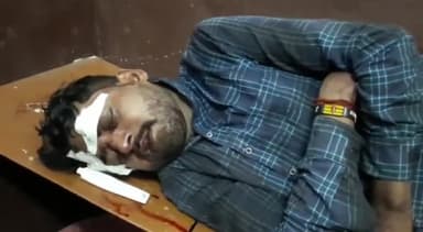 सवायजपुर: पाली थाना क्षेत्र में शाहाबाद मार्ग पर आमने सामने हुई बाइकों की भिड़ंत में दो युवक हुए घायल