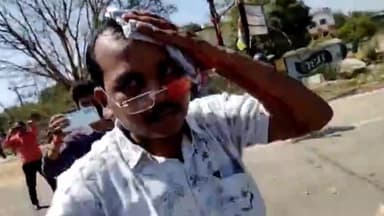 कांके: रांची धुर्वा में बीजेपी द्वारा सचिवालय घेराव कार्यक्रम में हुए लाठी चार्ज में एक पत्रकार को लगी चोट।