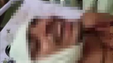 भिंड नगर: भिंड-ग्वालियर रोड पेड़ा के पास बाइक फिसलने से बाइक चालक हुआ घायल