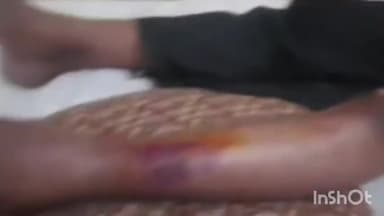 गुना नगर: बजरंगगढ़ रोड ओवरब्रिज पर दो बाइकों की आमने-सामने से हुई जोरदार भिड़ंत, हादसे में तीन लोग हुए घायल