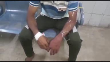 अररिया: छतियोना में मुर्गी के बच्चे को बचाने के क्रम में व्यक्ति को सांप ने काटा, घायल को सदर अस्पताल में कराया गया भर्ती