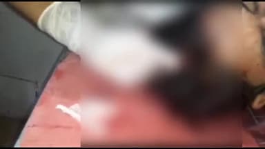 अररिया: गैयारी ओवरब्रिज के समीप सड़क पर पड़े मक्का पर बाइक सवार फिसल जाने से गिरकर हुआ घायल सदर अस्पताल में भर्ती