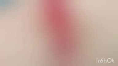 हुज़ूर: ऐशबाग में बदमाशों ने युवक पर किया जानलेवा हमला, अस्पताल में चल रहा इलाज