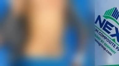 हुज़ूर: टीला जमालपुरा इलाके में शराब पीने के लिए पैसे नहीं दिए तो बदमाश ने ऑटो चालक को मार दिया चाकू