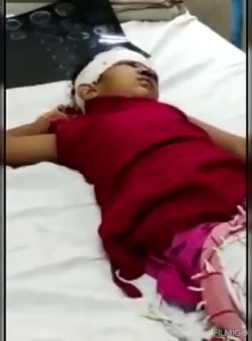 कोटा के अनंतपुरा में एक चार साल की बालिका आयशा खेलते समय छत से नीचे जा गिरी। जिससे उसके सिर व शरीर में कई जगह चोटें आई